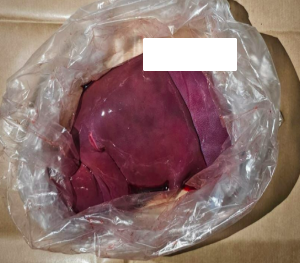 20250613_man_arrested_for_loanshark_harassment_3