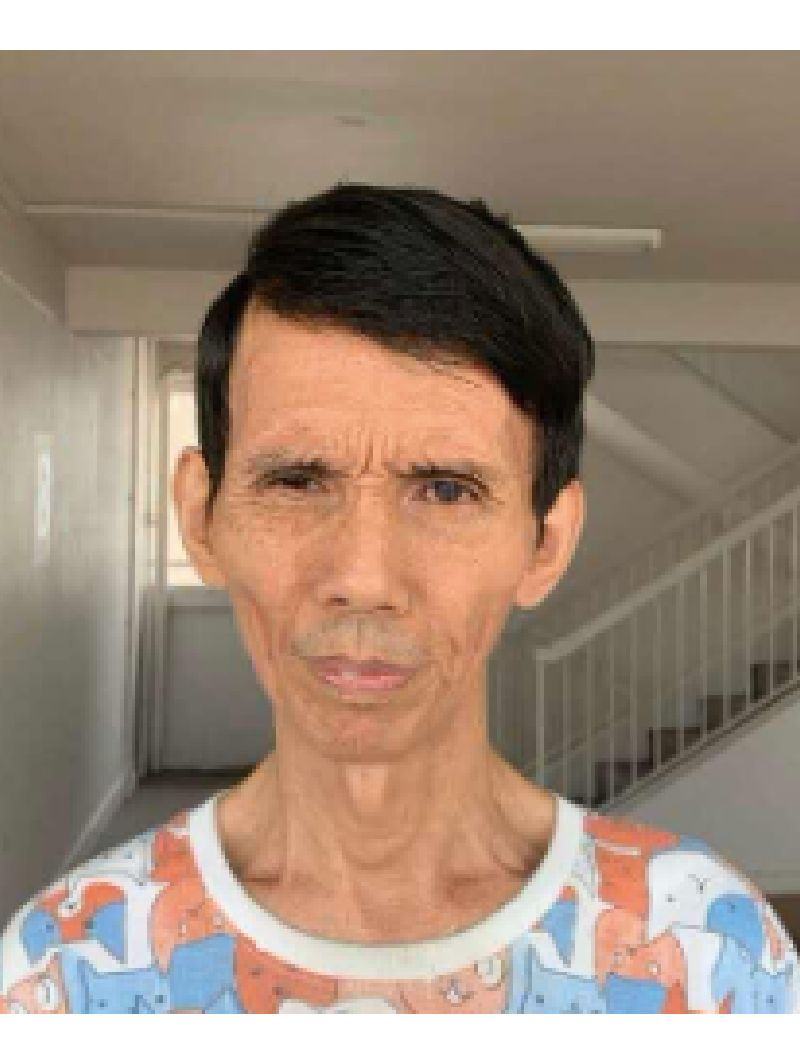 202650104_appeal_for_information_mr_chew_chin_yuen_teaser